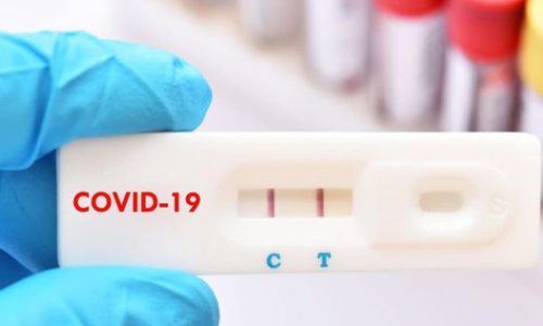 SANTÉ : opération massive de dépistage Covid-19 à Villers